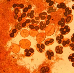 spores de melanosporum grossies quatre cent fois
