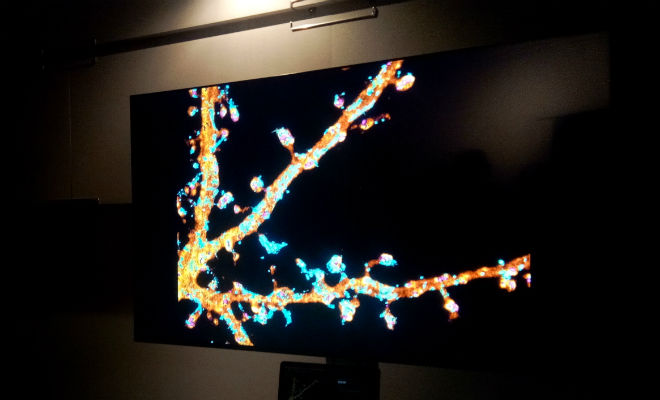 Imagerie de pointe pour l'observation du cerveau au sein du Bordeaux Imaging Centre, hébergé au sein du Centre Brocas sur le Neurocampus